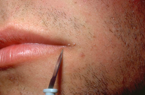 Emri:  oral-hpv.jpg

Shikime: 19773

Madhsia:  31.7 KB