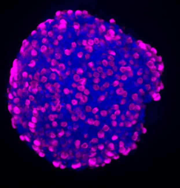 Emri:  Low-Res_Enteroendocrine cells in organoid.jpg.jpg

Shikime: 137

Madhsia:  40.5 KB