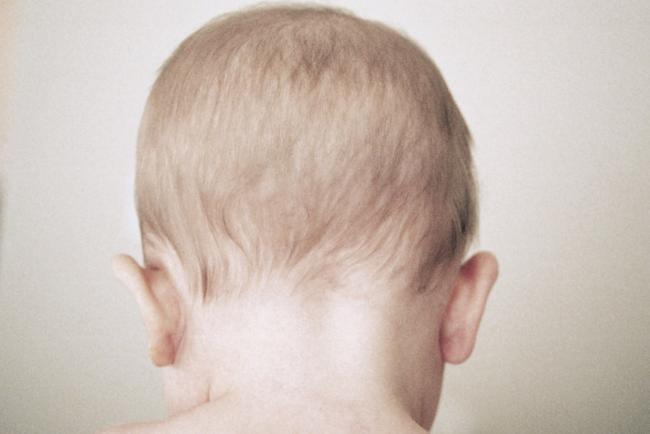 Emri:  221215-baby-hair-biomarker-autism-se-1212p-03c4b7.jpg

Shikime: 270

Madhsia:  23.1 KB