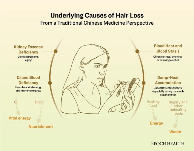 Emri:  id5862606-Hair-loss-infographic-000.jpg

Shikime: 3

Madhsia:  36.5 KB