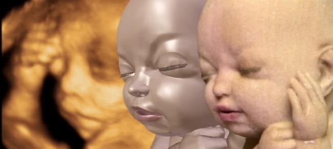 Emri:  3D-Printed-Foetus.jpg

Shikime: 353

Madhsia:  18.8 KB